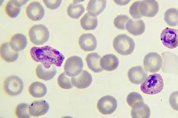 Center for Global Infectious Disease Research